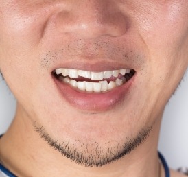 Calgary Orthodontic Dentistry | Shawnessy Smile Dental