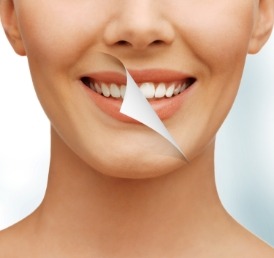 Calgary Teeth Whitening | Shawnessy Smile Dental