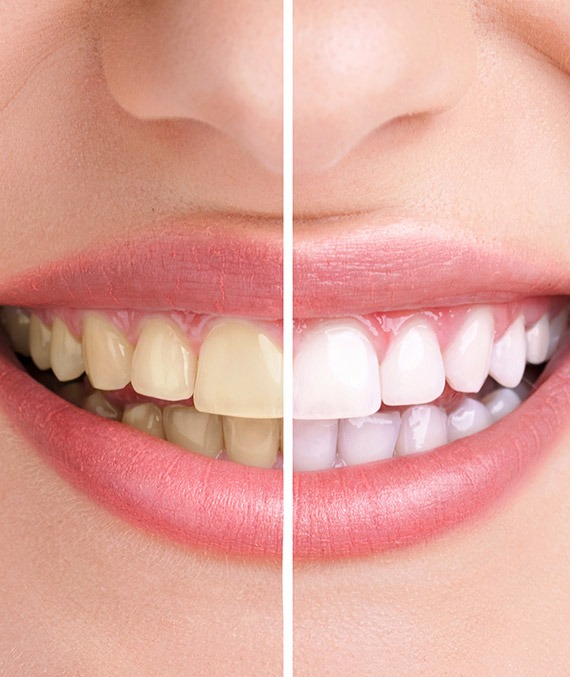 Southeast Calgary Restorative and Cosmetic Dentistry | Shawnessy Smile Dental