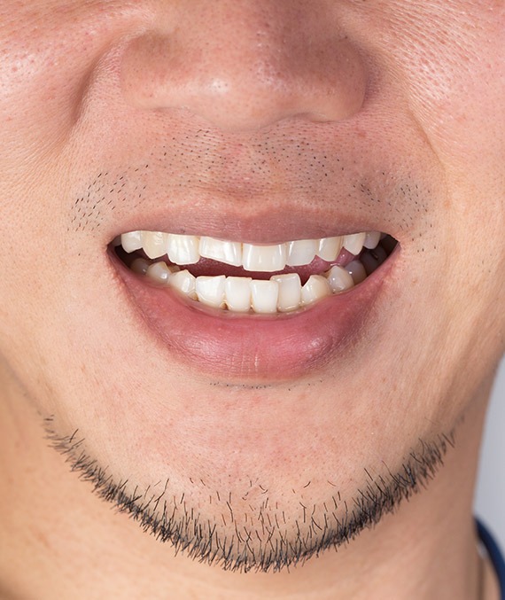 Southwest Calgary Orthodontic Treatment | Shawnessy Smile Dental