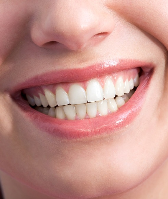 Calgary Restorative Treatments | Shawnessy Smile Dental